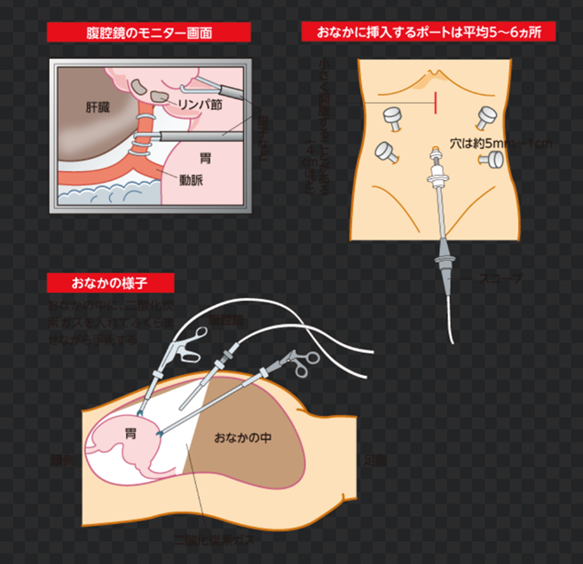 ひとこと解説1