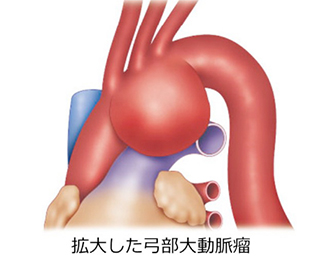 TAA_surgical_01