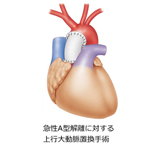 TAA_surgical_03
