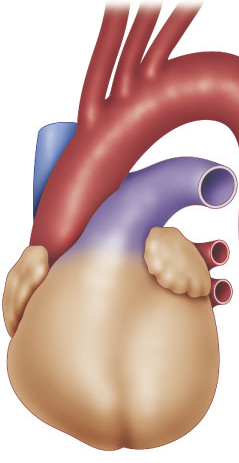 arrhythmia_surgical_05