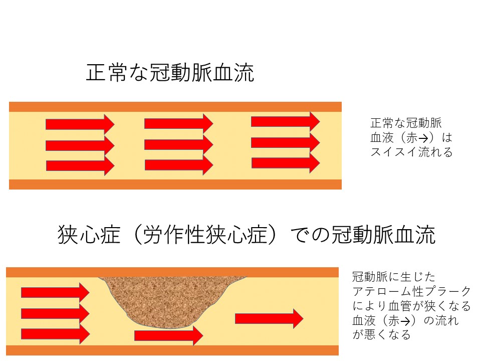cad_01