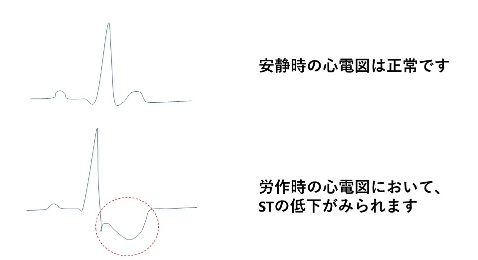 cad_03
