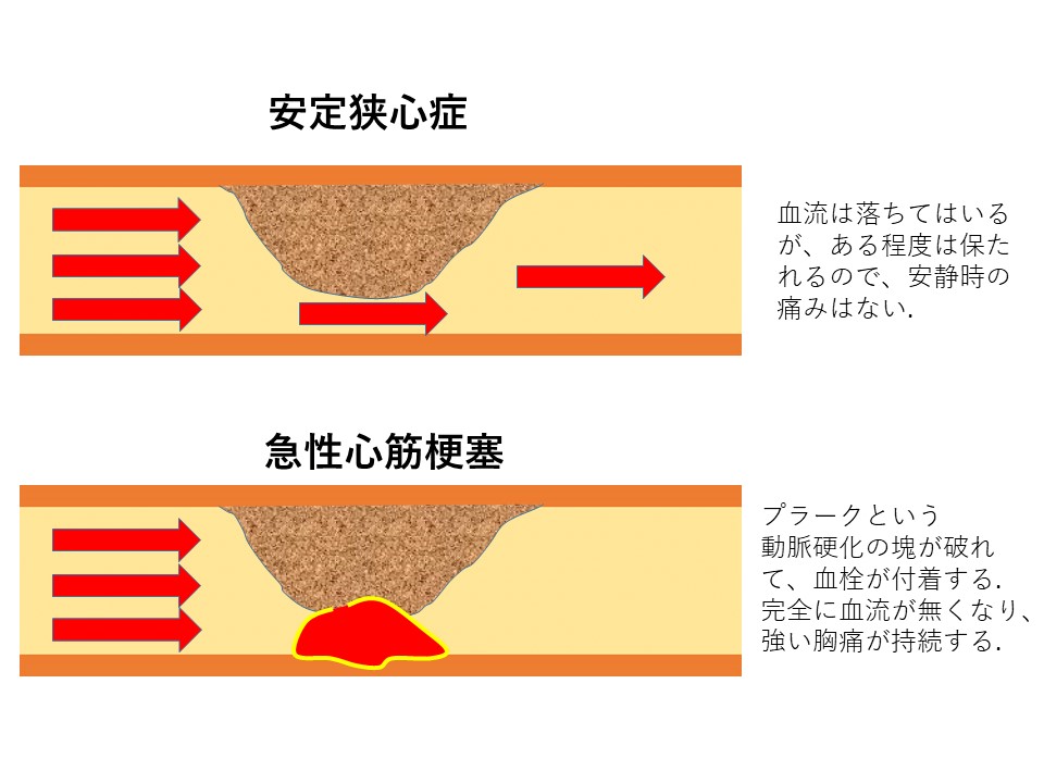 cad_10