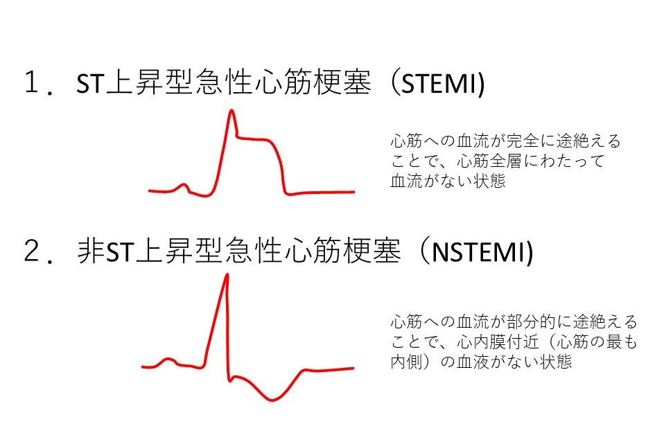 cad_11