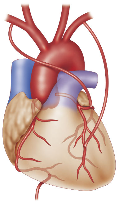 cad_surgical_01