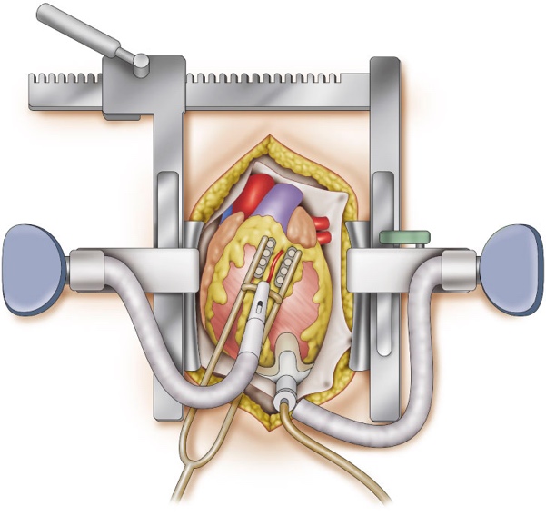 cad_surgical_02