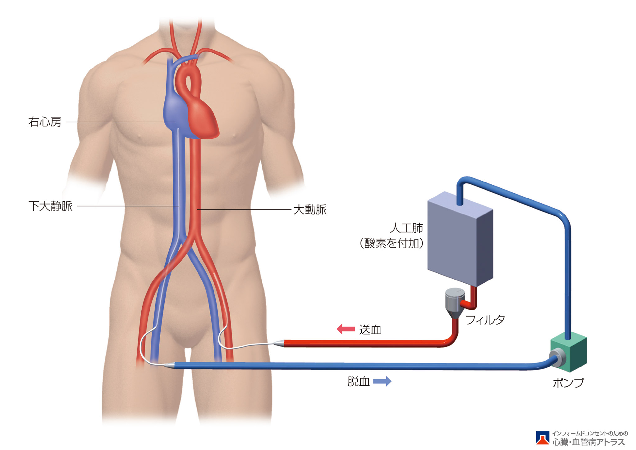 heart_failure_surgical_02