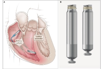 pacemaker_07