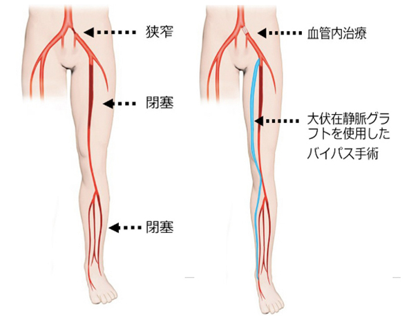 pad_surgical_01