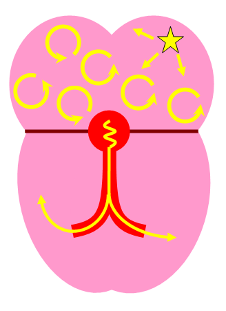 tachycardia_08