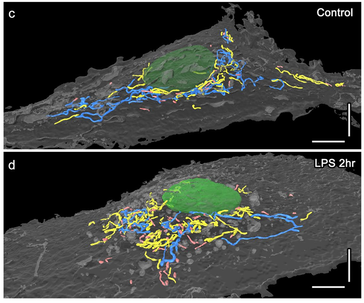 Inflammation-induced mitochondrial morphological changes