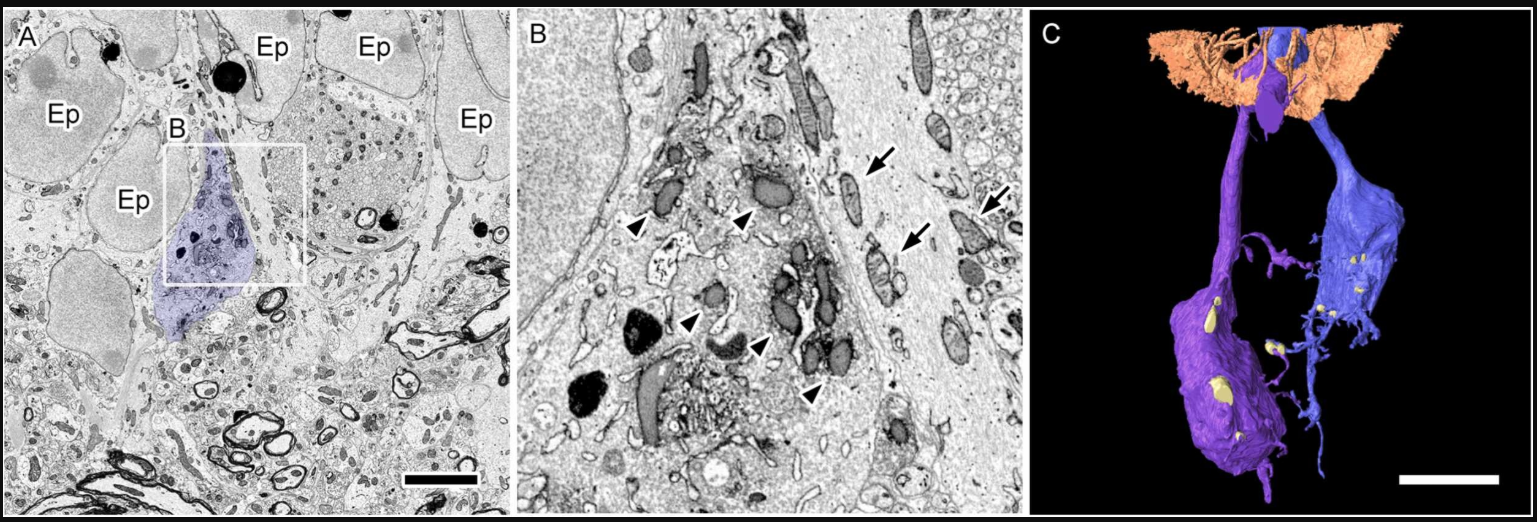 Ultrastructural analysis of genetically labeled neurons using EM labeling