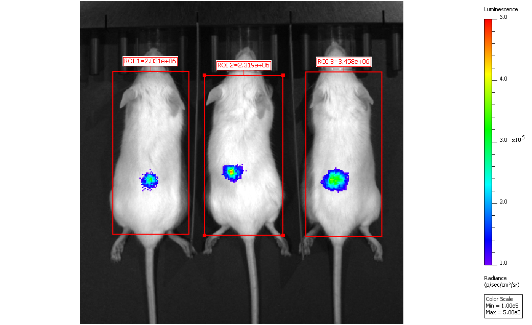 エピジェネティクス制御による抗腫瘍治療開発