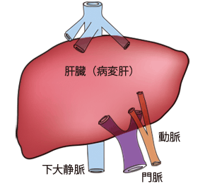 肝臓の摘出